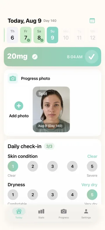 IsoPal Today screen showing a logged 20 mg dose, progress photo, skin condition, and dryness check-in