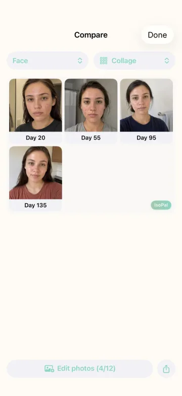 IsoPal photo collage showing four treatment stages